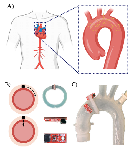 Autoregulation