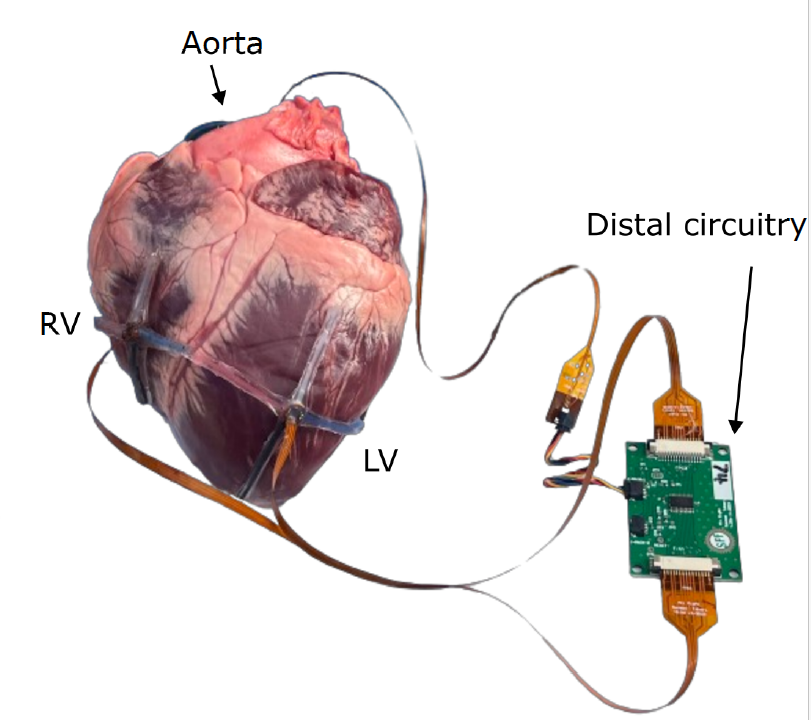 Durable strain sensor