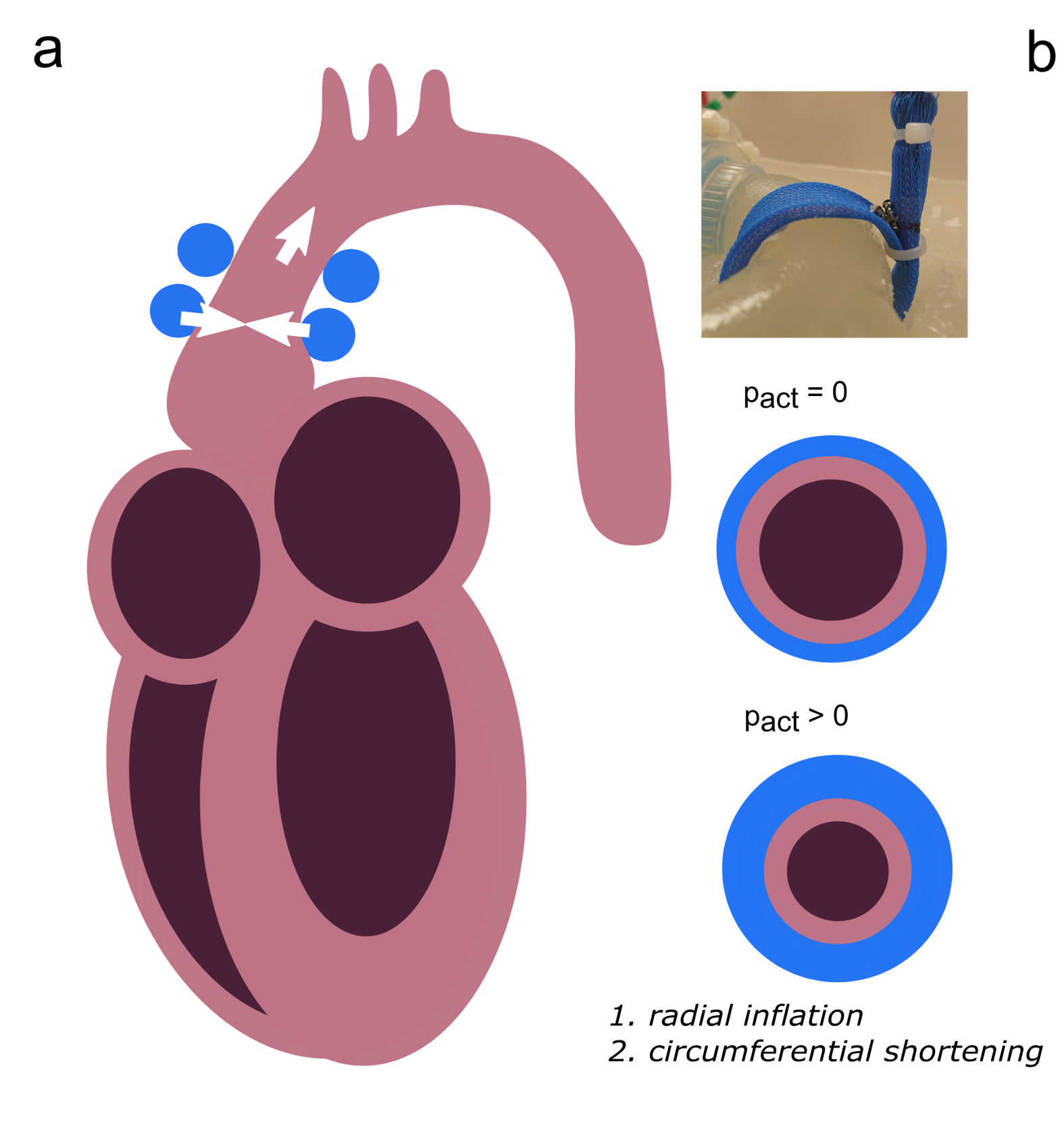 Soft robotics for the heart